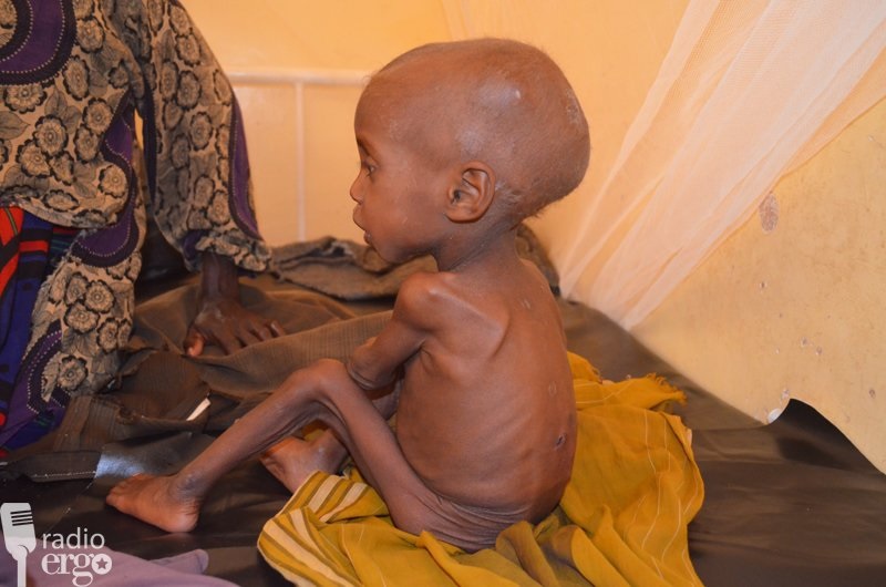 CHILDREN STARVE AS FOOD STOCKS RUN OUT IN BAIDOA.